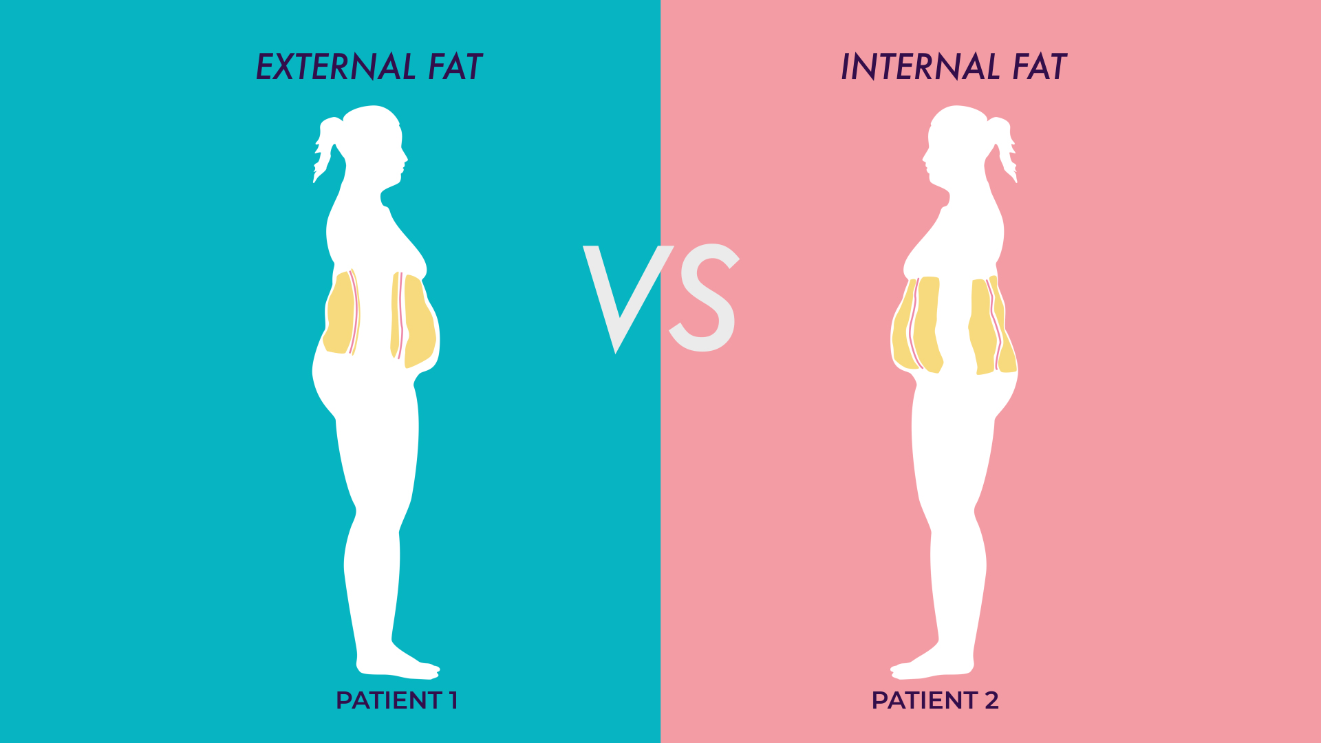 How To Tell If You Have Internal or External fat?